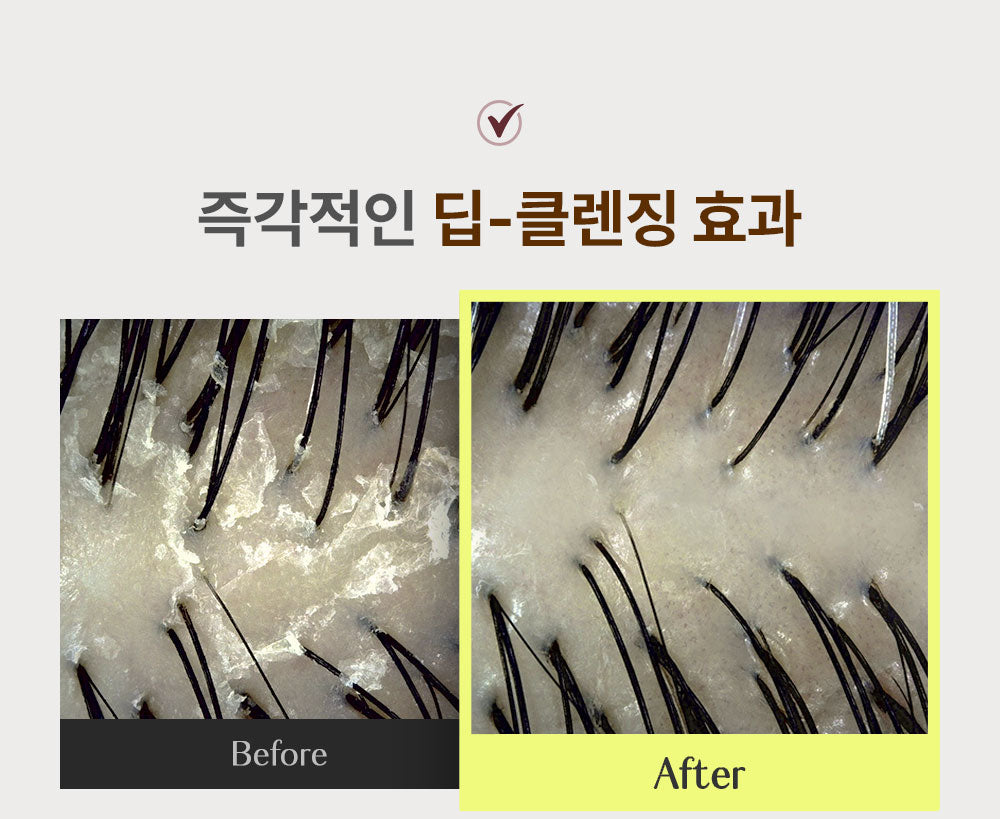 hetras. Simkong Perfume Anti-Hair Loss Shampoo | 1013ml